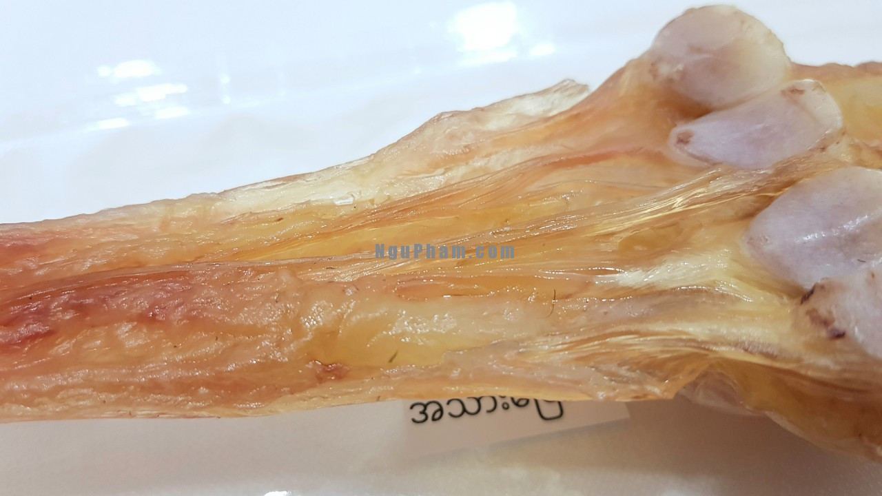 z4213957898468_b2847d90c568f5adeece09272d39aecf